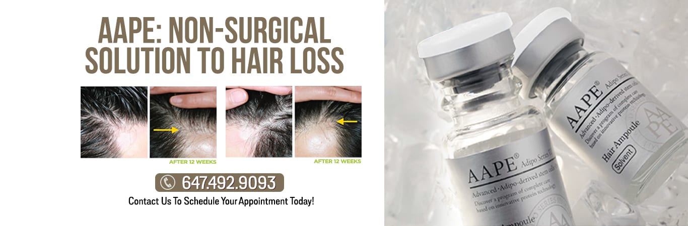 Hair Loss Clinic | Hair Loss Treatments in Toronto GTA