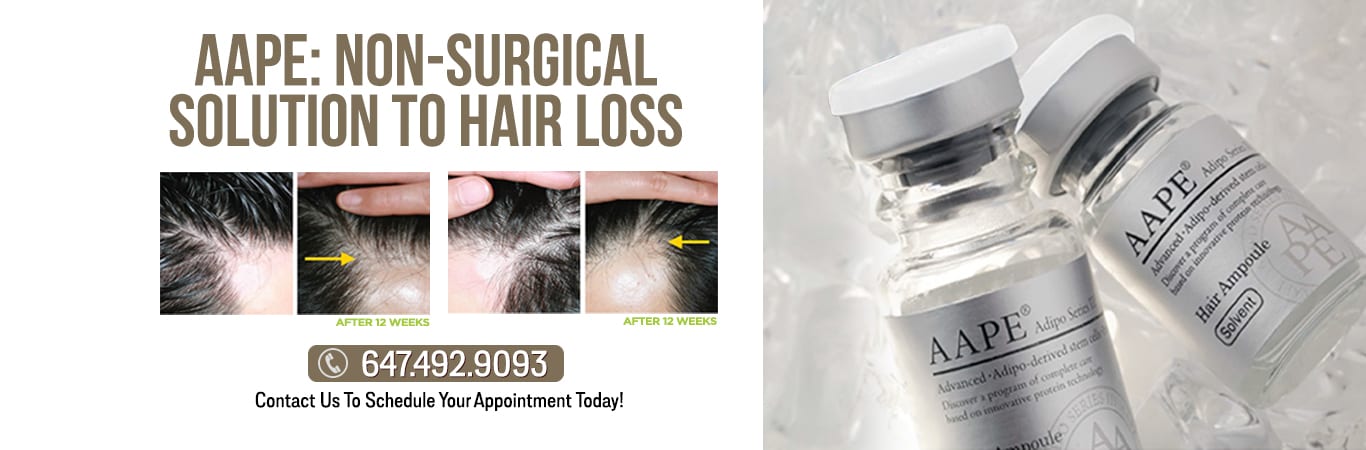 AAPE hair loss clinic toronto and gta