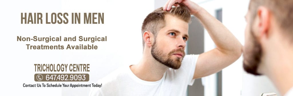 MALE HAIR LOSS CONDITIONS