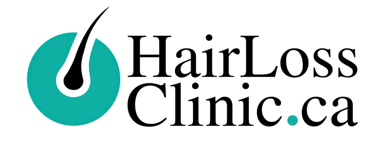 Laser Light Hair Loss Therapy | Hair Loss Clinic Toronto