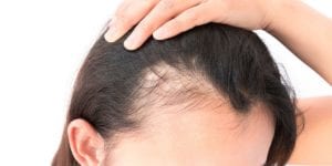 portland-female-hair-loss-treatment-1200x600