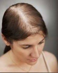 womens hair loss