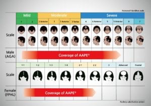 AAPE for androgenetic hair loss