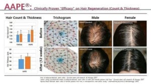 AAPE Hair Regeneration Count & Thickness