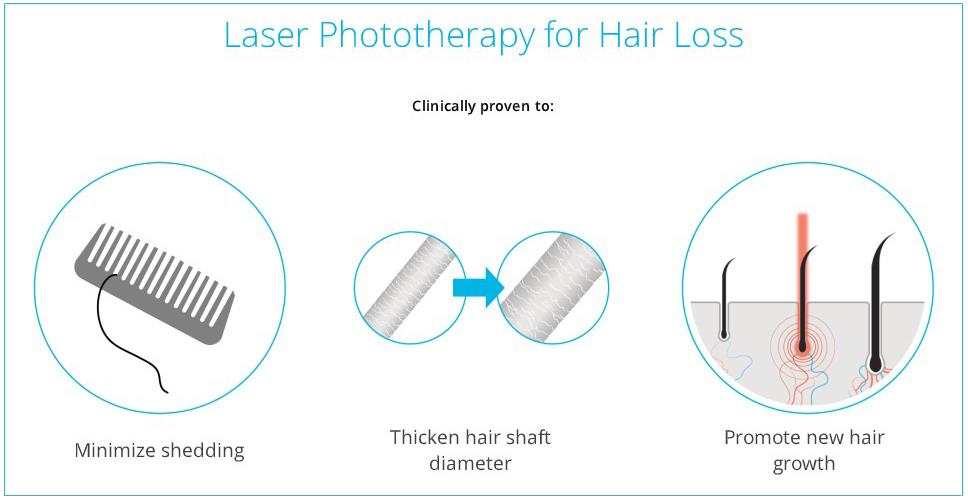 Laser hair growth treatment Toronto ON