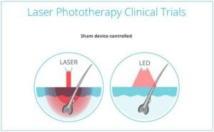 laser hair growth treatment Toronto