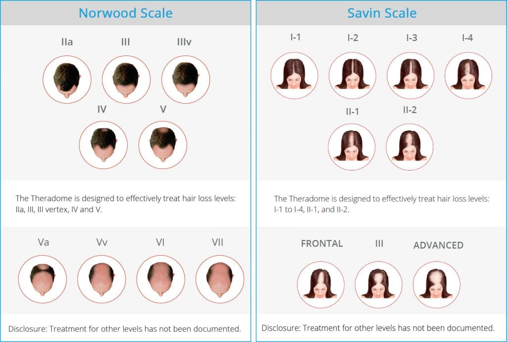 norwood scale