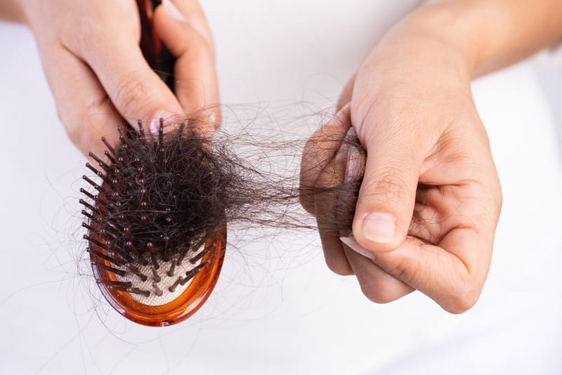 hair loss in women and womens hair loss treatment Toronto