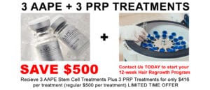 PRP and AAPE treatment