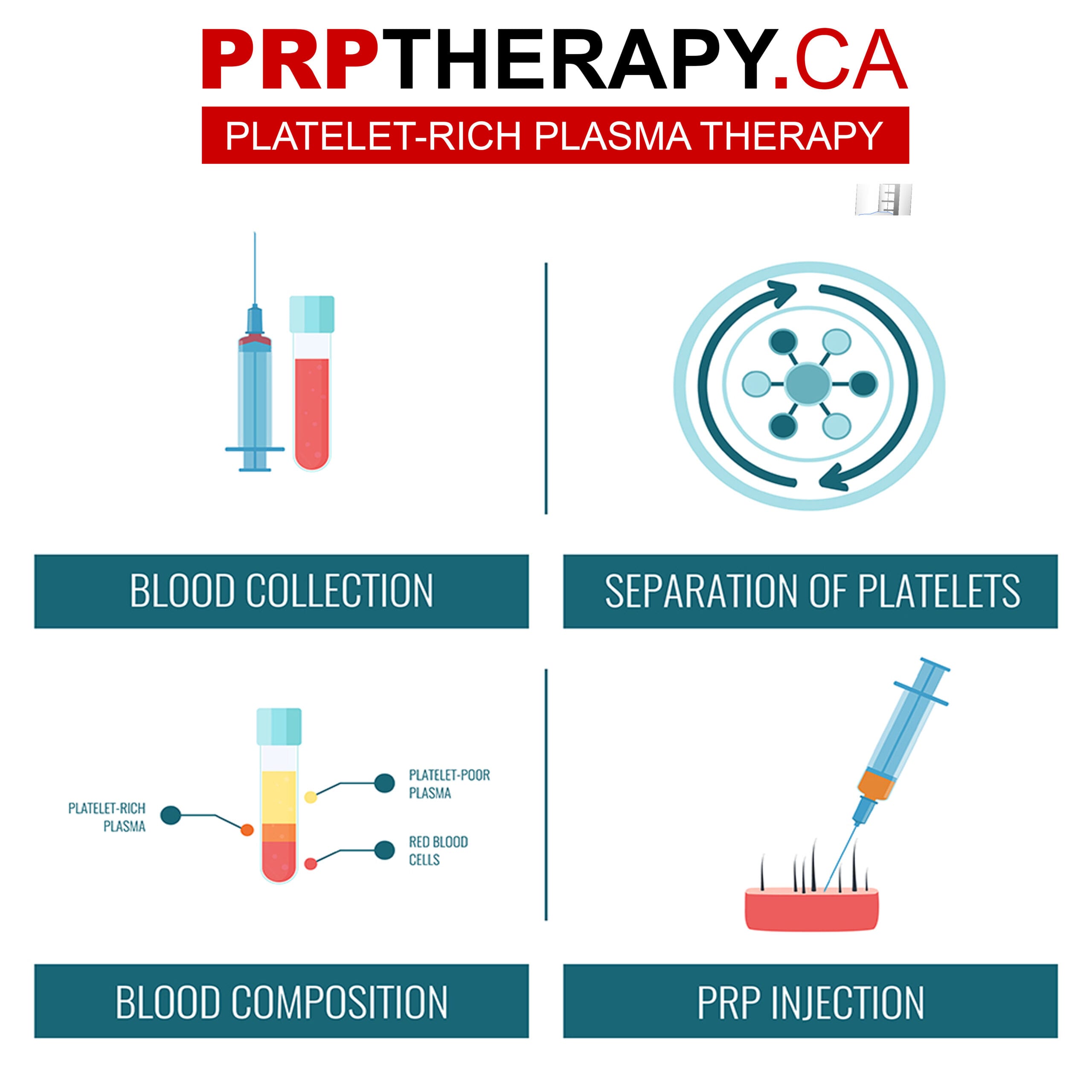 platelet-rich plasma