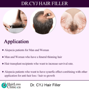 Dr-CYJ-Hair-Filler