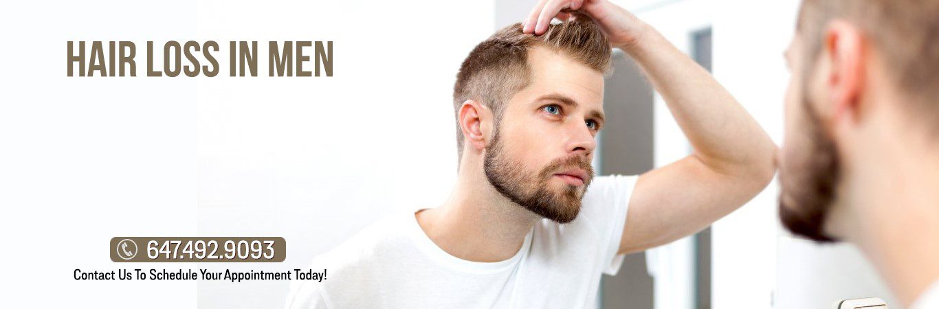 hair loss men clinic Toronto