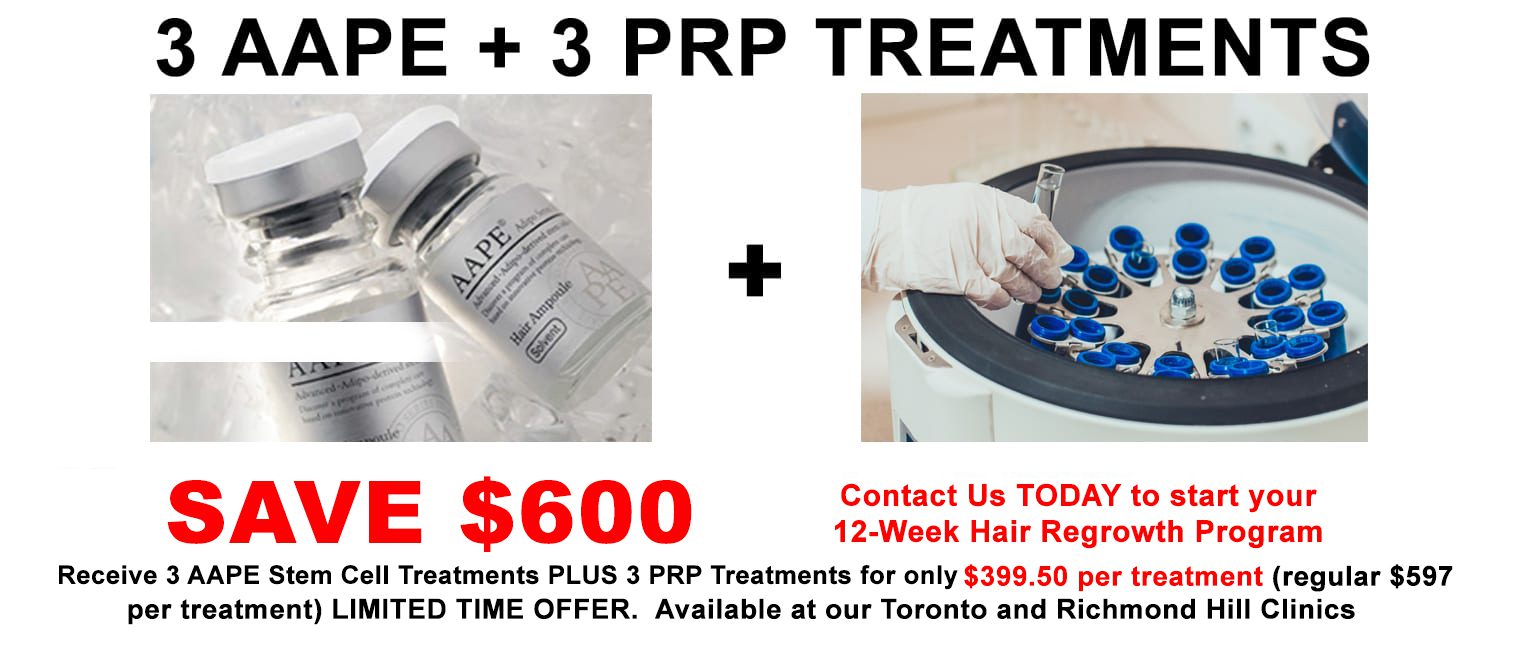PRP and AAPE hair loss special