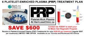 PRP hair loss cost