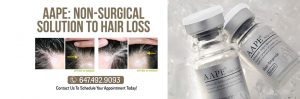AAPE hair loss treatment Toronto