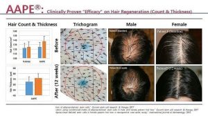 AAPE hair loss treatment Toronto