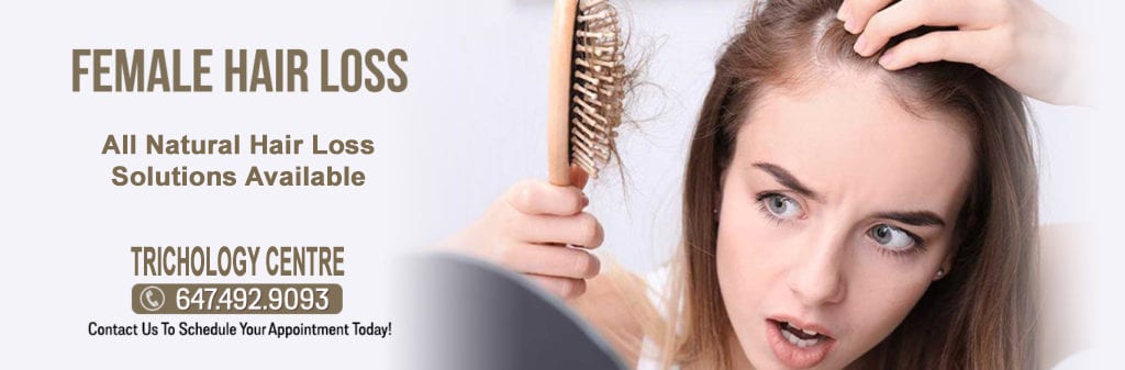 womens hair loss and treatment Toronto Trichology