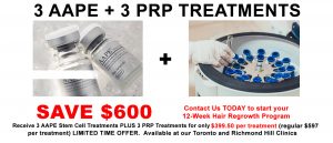 AAPE and PRP Hair Treatment Toronto
