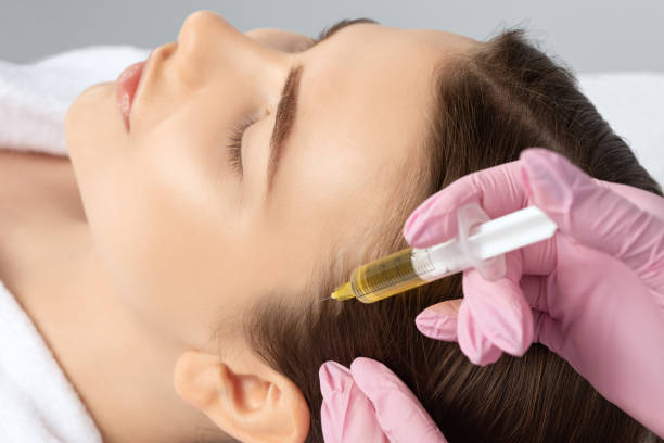 prp hair treatment women hair loss