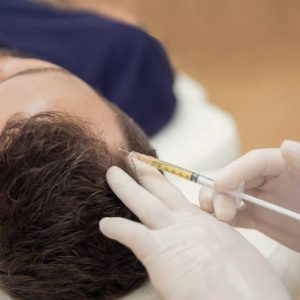 prp hair treatment - prp treatment - prp injection