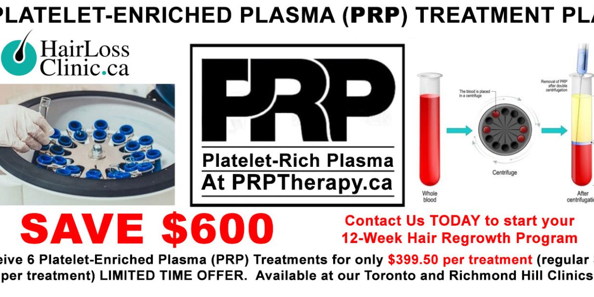 PRP-hair-loss-cost