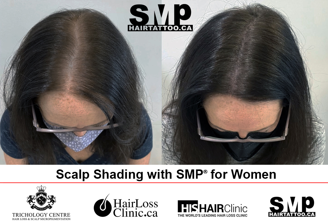 About SMP & Our Clinic, Scalp Culture