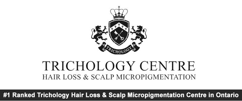 scalp micropigmentation - hair tattoo - trichologist Toronto