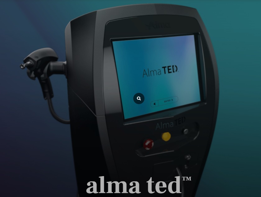 Alma TED