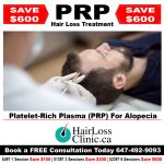 PRP Toronto - PRP hair treatment - PRP in hair treatment