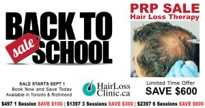 PRP-hair-treatment-PRP-in-hair-treatment-PRP-hair-PRP-Toronto