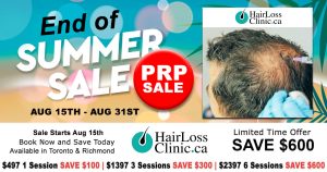 PRP-hair-treatment-PRP-in-hair-treatment-PRP-hair-loss-treatment