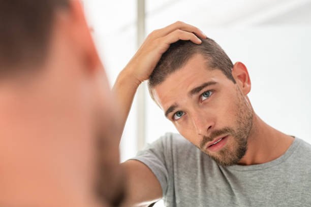hair loss treatment - hair loss treatments Toronto