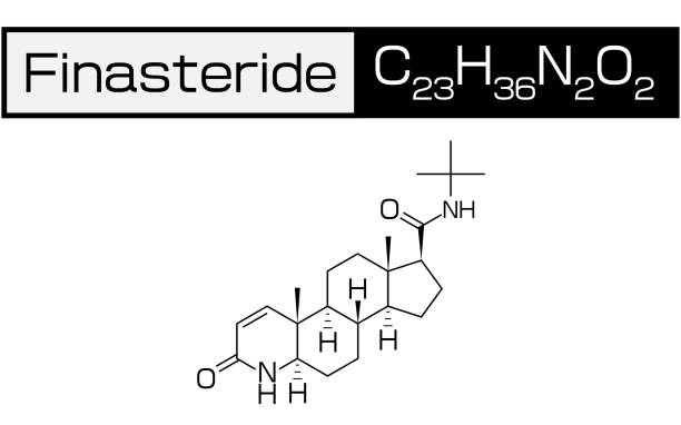 Finasteride Side Effects A Comprehensive Guide Trichology Centre 2766