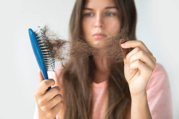 female hair loss - spironolactone for hair loss