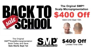 scalp micropigmentation - hair tattoo - scalp tattoo