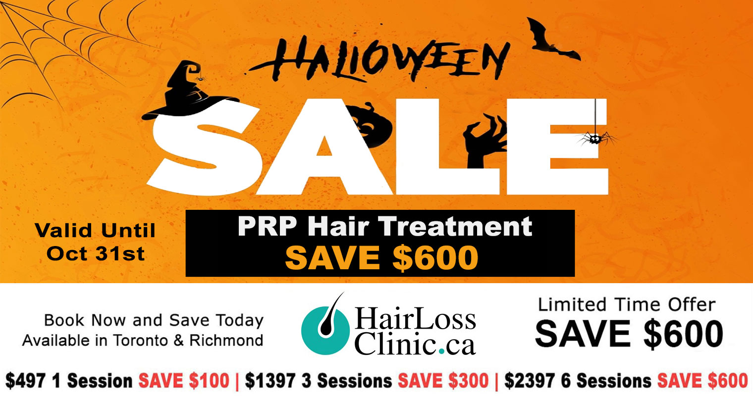 PRP-hair-treatment---PRP-treatment---PRP-in-hair-treatment