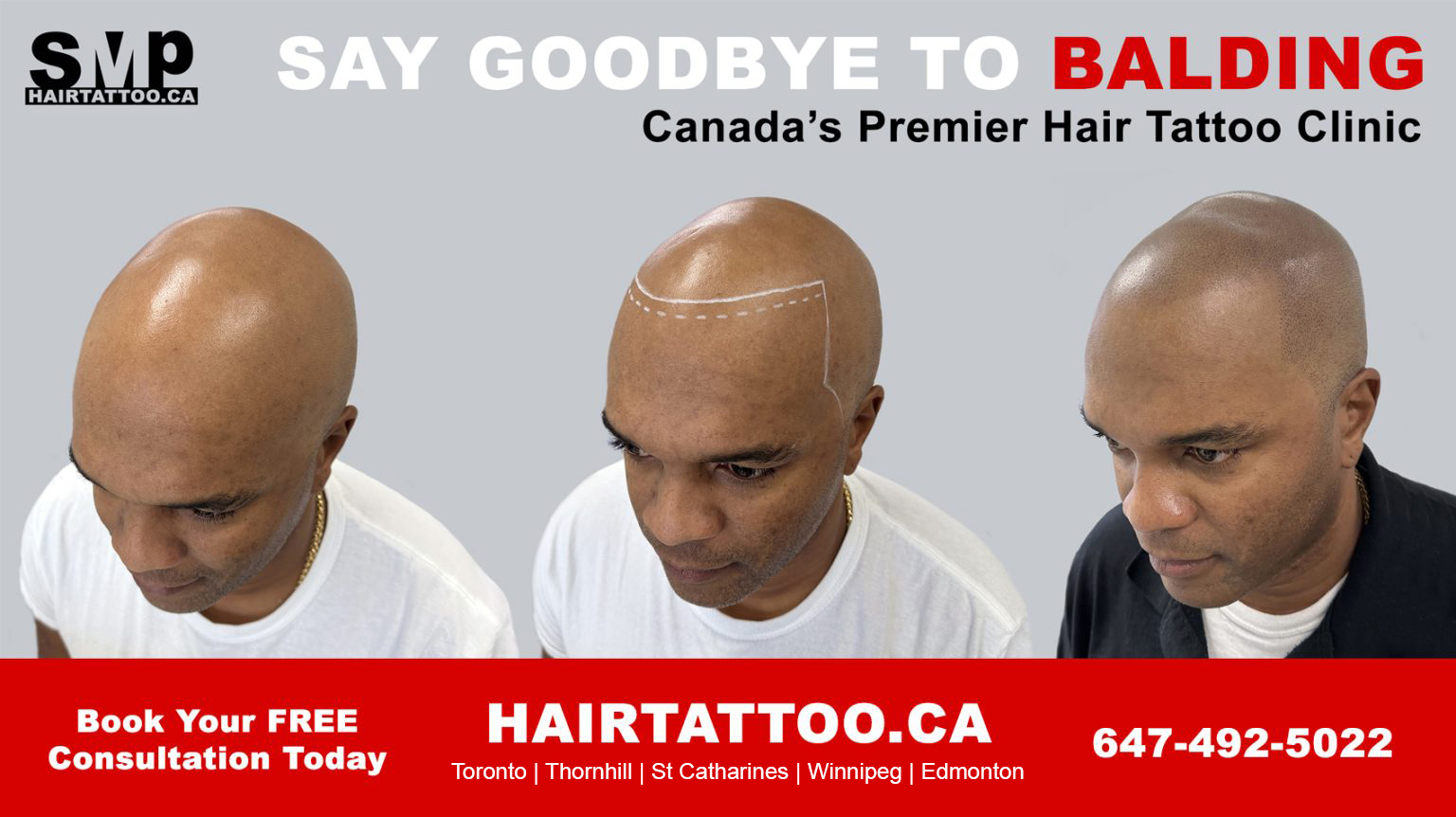 scalp-micropigmentation-hair-tattoo-hairline-tattoo-Toronto-1536x862