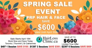 hair-loss-clinic-toronto