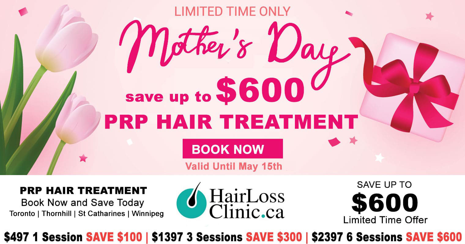 PRP-Hair-Treatment-PRP-Treatment-Hair-Loss-Clinic-Toronto