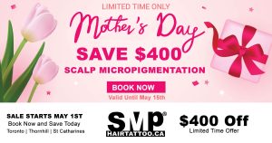 scalp-micropigmentation-Toronto-hair-tattoo