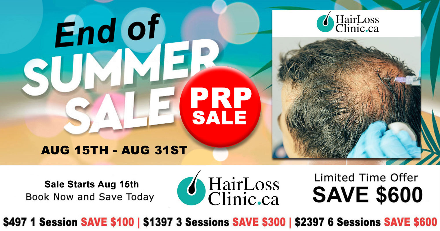 PRP-hair-treatment-PRP-in-hair-treatment-PRP-hair-loss-treatment-toronto